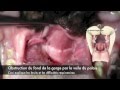 Ronflement du bouledogue et chirurgie au laser syndrome brachycphale du chienm4v