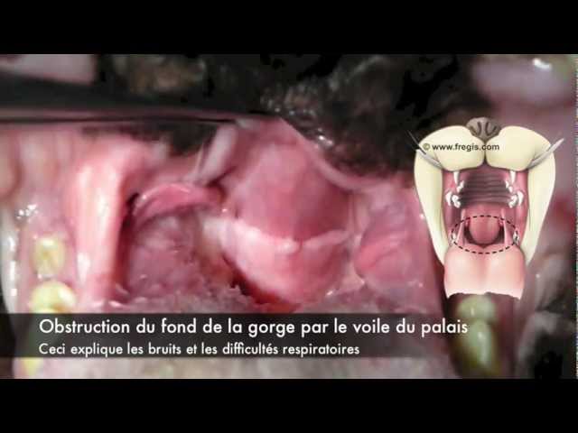 Ronflement du bouledogue et chirurgie au laser. Syndrome brachycéphale du  chien.m4v