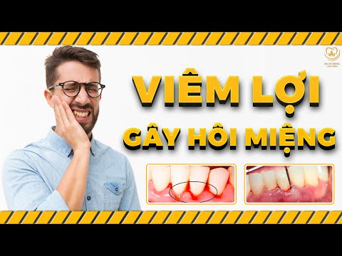 cách vệ sinh răng miệng đúng cách tại Kemtrinam.vn