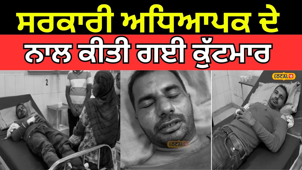 Fazilka News | ਸਰਕਾਰੀ ਅਧਿਆਪਕ ਦੇ ਨਾਲ ਕੀਤੀ ਗਈ ਕੁੱਟਮਾਰ, ਨੌਜਵਾਨਾਂ ਨੇ ਪਾਇਆ ਘੇਰਾ | #local18