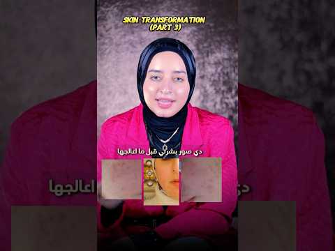 ماحدش هيقولك المعادله ديه إصلاح حاجز البشرة في 4 خطوات بس