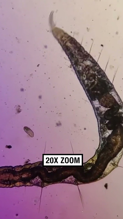 Tap water vs Holy Water under the microscope! 🔬🤢  -  🎥 microscope.vision