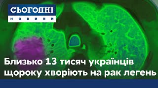 Онкологія не вирок: 13 тисячам українців щороку діагностують рак легень