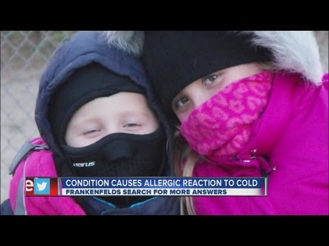 Rare condition causes