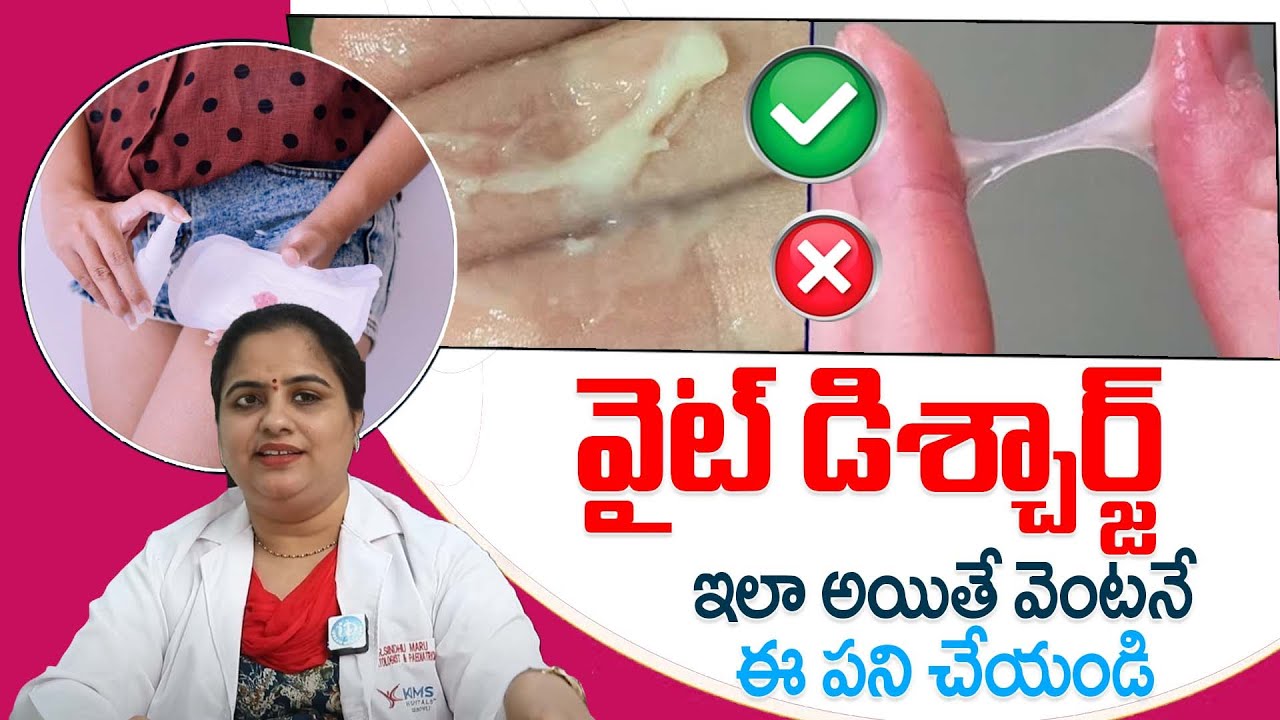 తెల్లబట్ట ఇలా ఉంటె | Normal & Abnormal White Discharge In Telugu | Vaginal Discharge Types | iDream