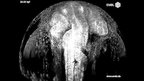 Zebrafish brain developing