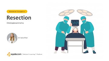 Cholangiocarcinoma | Resection