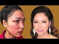 Trang Điểm Che Mụn Dị Ứng Cho Cô Dâu Đẹp Không Tì Vết _ Hùng Việt Makeup