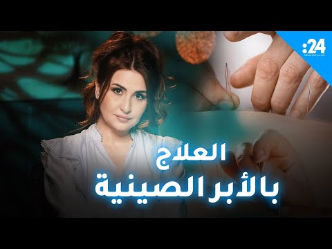 شيفرة علا الحلقة 9 العلاج بالأبر الصينية