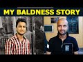 My baldness story | How to overcome fear of baldness