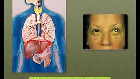 Sundaram Eclass Science concepts: Disease (Highway of Health )