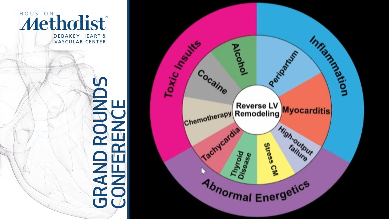 Heart Failure as a Progressive Disease (Douglas L. Mann, MD) November 19, 2020
