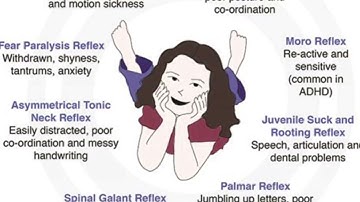Reflex Integration exercises for Fear Paralysis, TLR, Spinal Galant, ATNR & STNR
