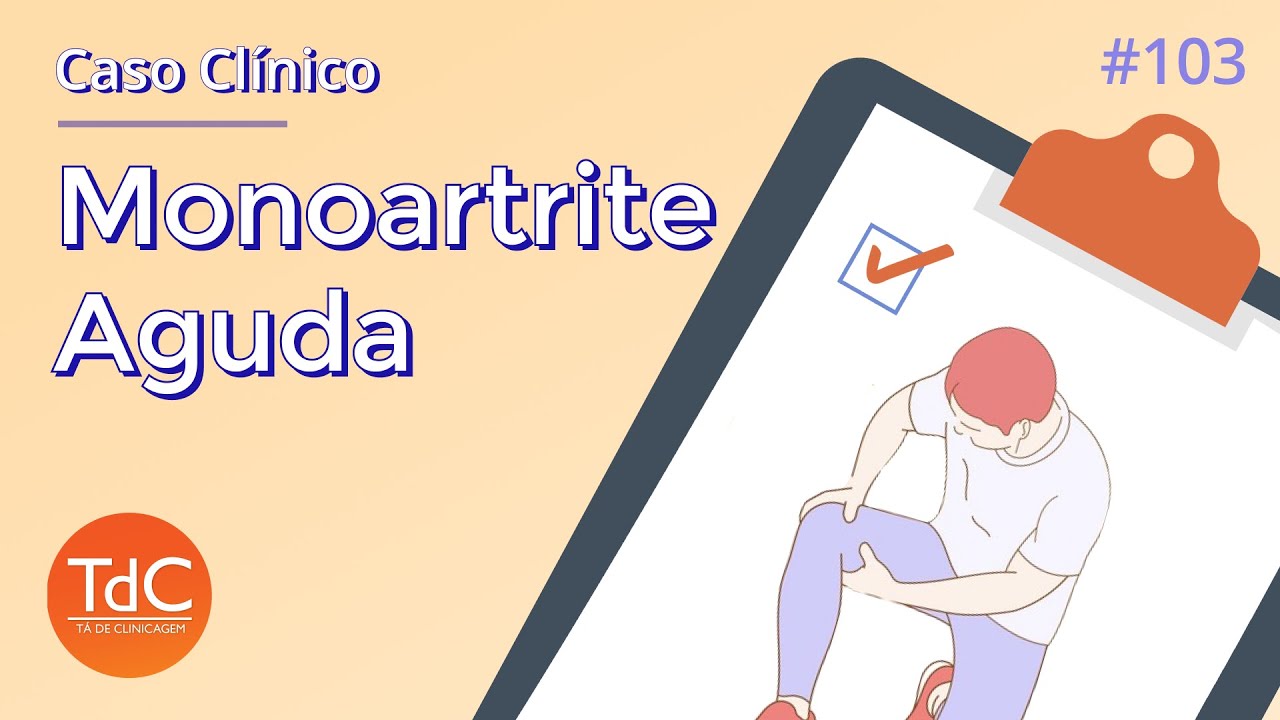 Thumbnail - Monoartrite Aguda: Discussão de Caso Clínico - Episódio 103