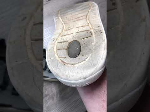 Crocs lite ride 3 года эксплуатации ПОСЛЕДСТВИЯ