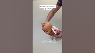 Cardinal Movements of Labor #givingbirth #childbirtheducation #pregnancyinformation #expectingmom