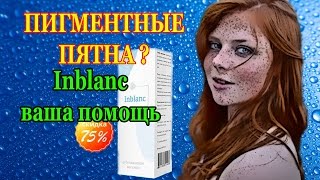 Как избавиться от пигментных пятен. Крем отбеливающий лицо. Inblanc. Крем от пигментных пятен.