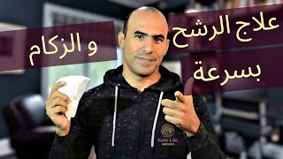 علاج الرشح و الزكام - زيادة سرعة علاج الزكام