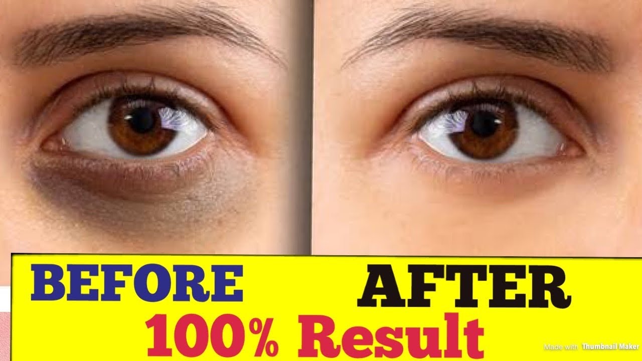 Bella Vita Eyelift Under Eye Gel Cream Review/Best eye gel for dark