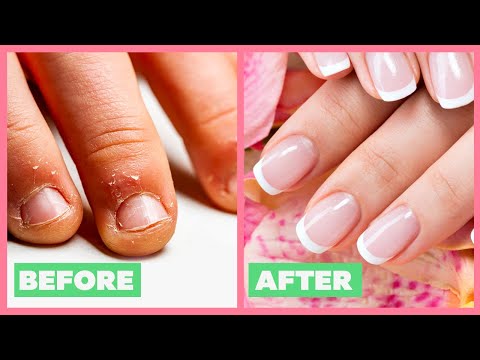 How To Grow LONG & Strong Nails At Home | नाखून लम्बे मजबूत कैसे बनाये | Nail Care | Be Beautiful