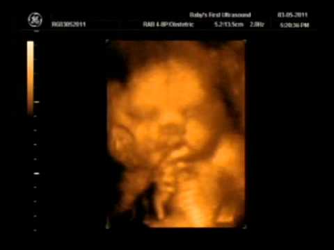 Baby Gallagher Movie