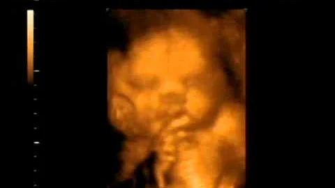 Baby Gallagher Movie