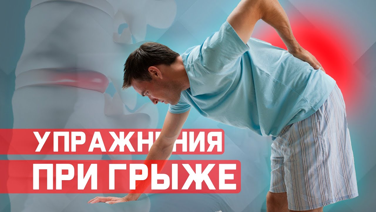 Упражнения при межпозвонковой грыже в пояснице. 1й - этап - YouTube