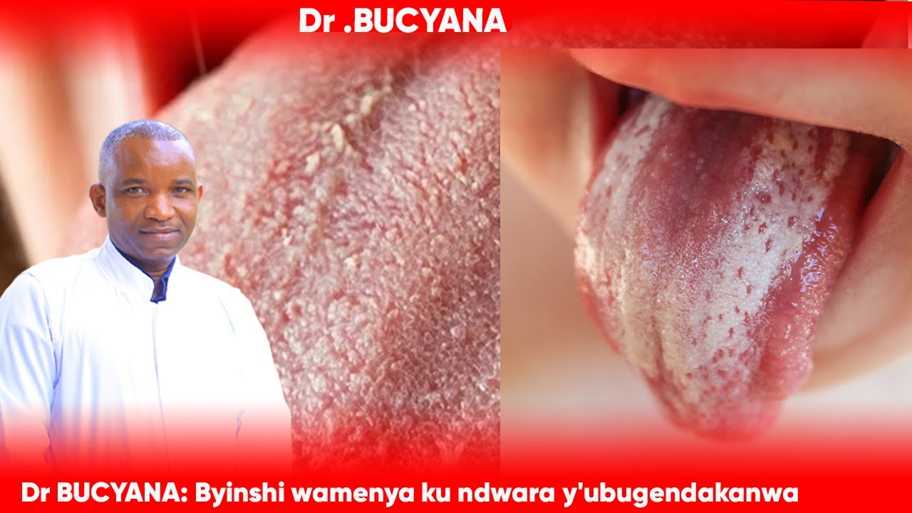 Dr BUCYANA: BYINSHI WAMENYA KU NDWARA Y'UBUGENDAKANWA IKUNZE KWIFATIRA ABANA.