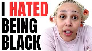 Doja Cat CONFIRMS Her Struggle With Being Black!