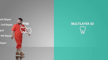 Why do you choose 3Dmultilayer zirconia？