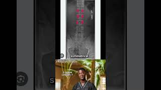 How to Read a Lumbar Spine X-Ray in 60 Seconds | X-Ray Basics