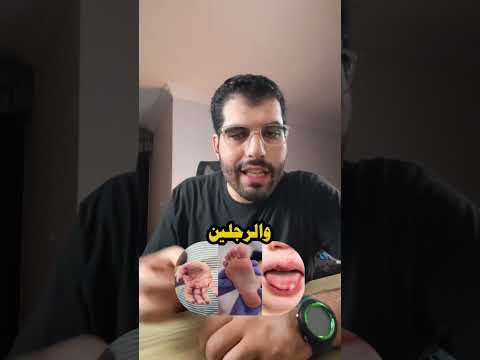 فيروس جديد يقفل مدرسة في مصر هل أولادنا في خطر الساينتست  