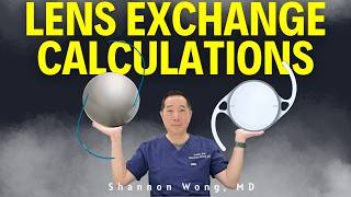 Calculating Iol Power For Iol Exchange When The Original Surgery Was Performed By Another Surgeon.