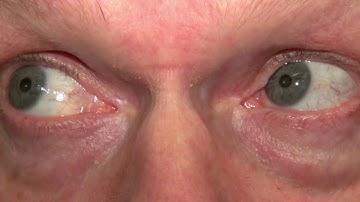 RS Supranuclear Ocular Motor Pathways Part 3 - Pursuit