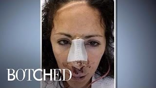 Her Crooked Nose Recalls Family Tragedy | Botched | E!