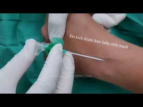 Video: Cách khắc phục sự cố khó chọc dò tĩnh mạch: 14 bước