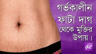 গর্ভকালীন ফাটা দাগ দূর করার সহজ উপায় | Pregnancy Stretch Marks in Bangla | Goodie Life screenshot 5