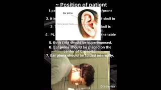 Mastoid view / schullar’s view in short #drt #radiographer_course #paramedicaleducation