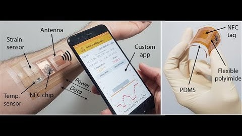 Smart Sensor Patch with Wireless Strain & Temperature Sensors & Batteryless NFC Tag
