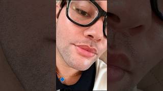 My First Lip Flip Experience | Botox Lip Flip Before & After