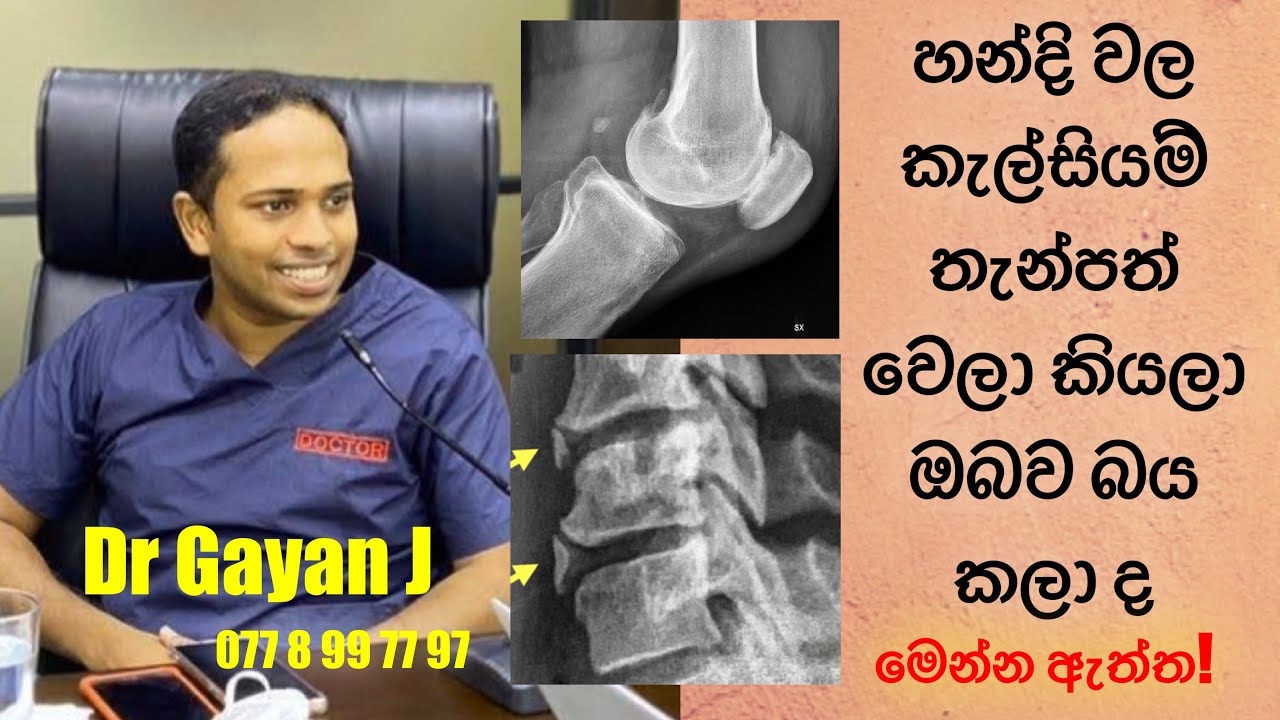 හන්දි වල කැල්සියම් තැන්පත් වෙලාද එහෙනම් මේක අනිවාර්යෙන් අහන්න 