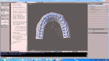 Cusp Finding and Tooth Segmentation