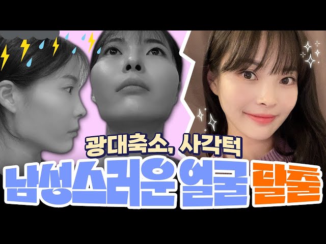 [광대축소+사각턱] 남자처럼 각진 얼굴형.. 이제 그만🖐 | 성형리뷰 | 에이비성형외과
