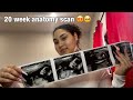 20 week anatomy scan / ultrasound | Lyenell & Selena