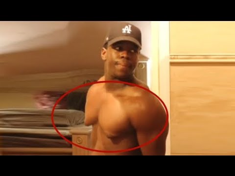 ✅Качок с жестким гино груди. Только ложную гинекомастию можно убрать диетой и тренировками. #shorts