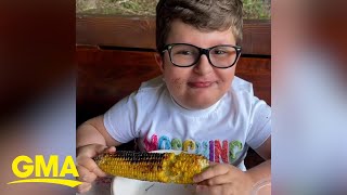 Boy with rare disease that makes him injury-prone finds community, friends on TikTok l GMA