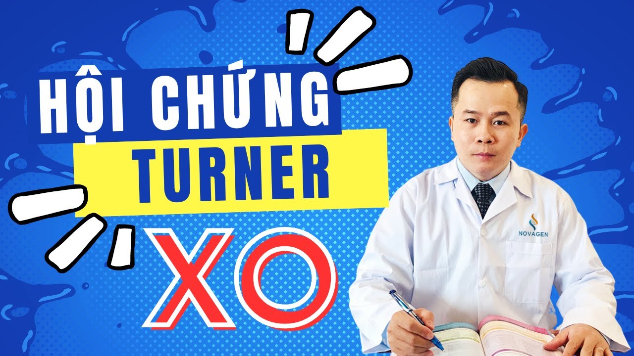 HỘI CHỨNG TURNER (45,X): Nguyên Nhân – Triệu Chứng – Ảnh Hưởng Đến Bé Gái Và Phụ Nữ