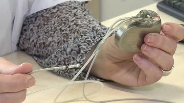 Voorlichtingsfilm over ICD en pacemaker