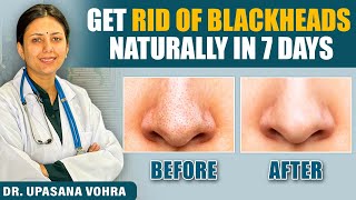 Skin Transformation Challenge | Remove Blackhead Naturally in 7 Days💕 | Upasana Ki Duniya