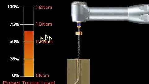 Fonction inversion automatique de l